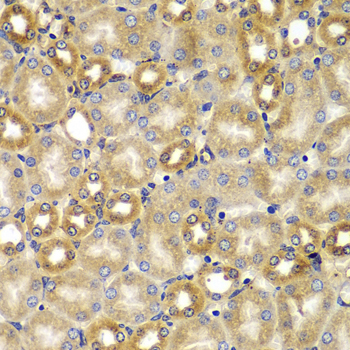 Immunohistochemistry of paraffin-embedded human placenta using Smad9 Rabbit pAb  at dilution of 1:100 