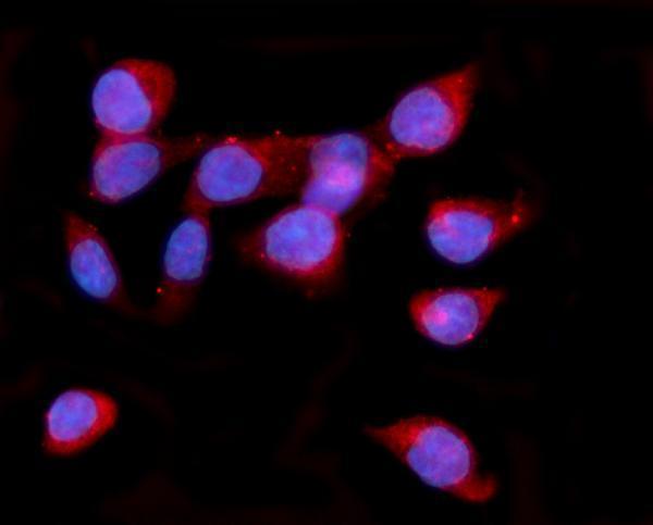 a04934 2 hyou1 primary antibodies if testing 10