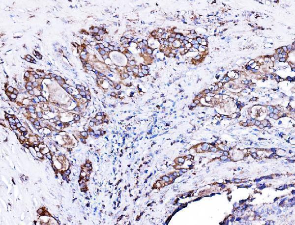 a04934 2 hyou1 primary antibodies ihc testing 2