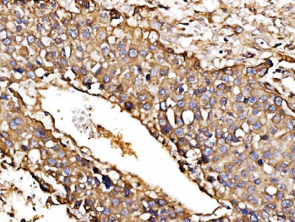 a04934 2 hyou1 primary antibodies ihc testing 5