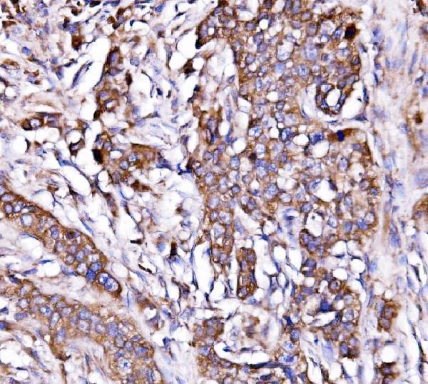 a04934 2 hyou1 primary antibodies ihc testing 6