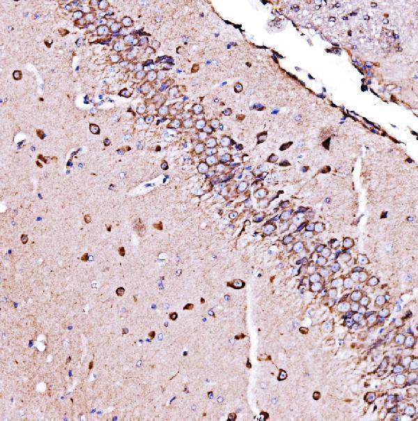 a04934 2 hyou1 primary antibodies ihc testing 8