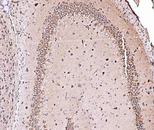 a04934 2 hyou1 primary antibodies ihc testing 9