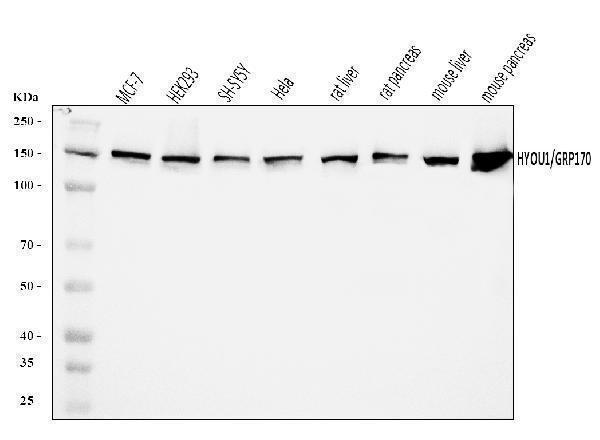 a04934 2 hyou1 primary antibodies wb testing 1