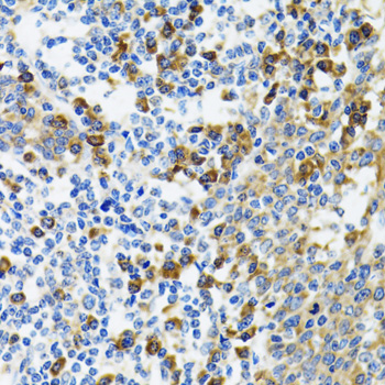 Immunohistochemistry of paraffin-embedded human vermiform appendix using ORP150/GRP170/HSP12A antibody  at dilution of 1:100 