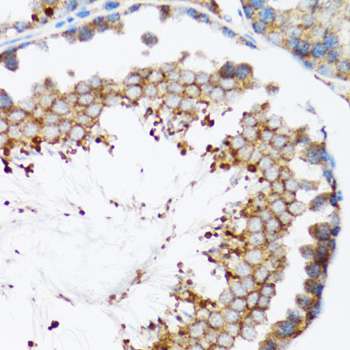 Immunohistochemistry of paraffin-embedded mouse testis using ORP150/GRP170/HSP12A antibody  at dilution of 1:100 