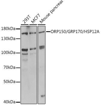 Western blot analysis of extracts of various cell lines, using ORP150/GRP170/HSP12A antibody  at 1:1000 dilution