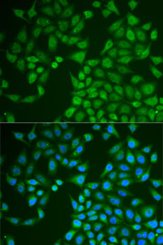 a04935 pnlip primary antiboties if testing 2
