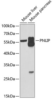 a04935 pnlip primary antiboties wb testing 1