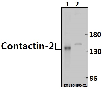Western blot (WB) analysis of CNTN2 pAb at 1:500 dilution
Lane1:The Brain tissue lysate of Mouse(40ug)
Lane2:U-87MG whole cell lysate(40ug)