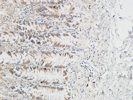 Immunohistochemical analysis of paraffin-embedded Human colon
