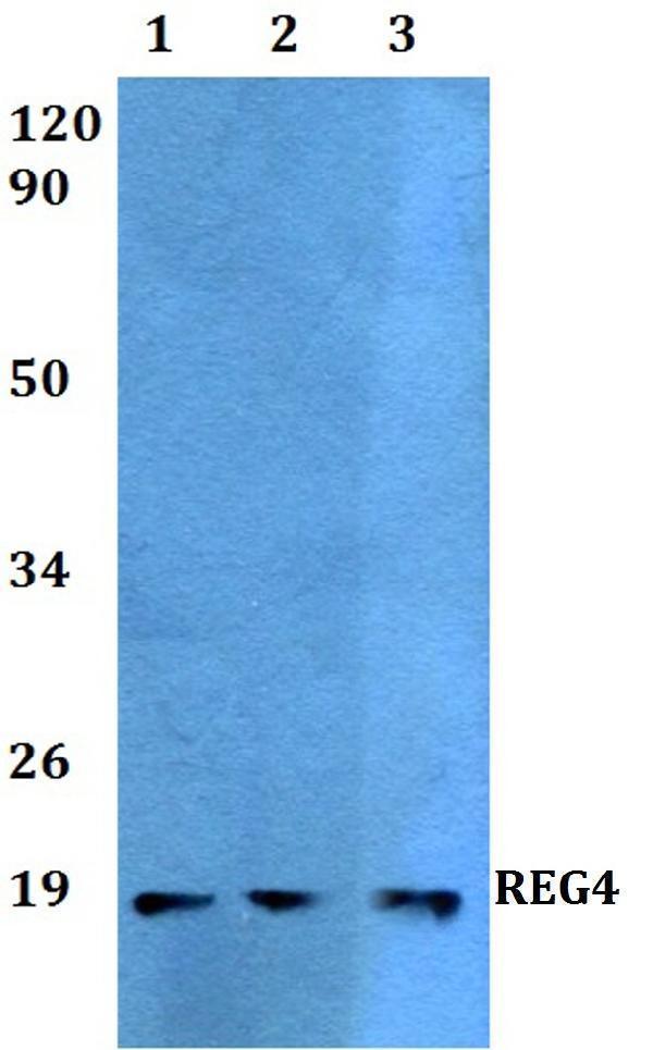 Western blot (WB) analysis of REG4 polyclonal antibody at 1:500 dilution
Lane1:HEK293T whole cell lysate
Lane2:Raw264