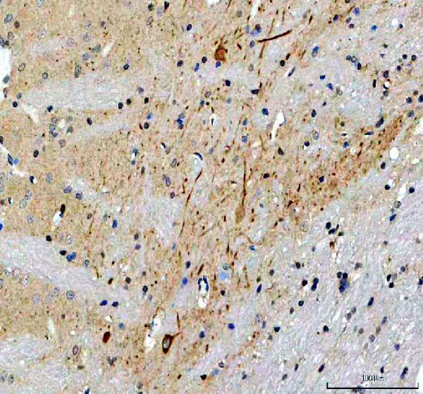 a04940 3 frg1 primary antibodies ihc testing 3