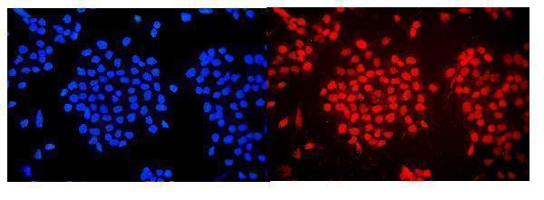 a04941 1 wac primary antibodies if testing 2