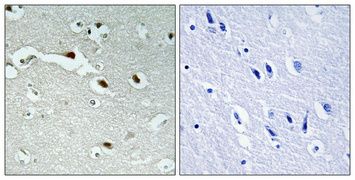 Immunohistochemistry validation of FOXJ1 using Anti-Forkhead box protein J1  FoxJ1 Antibody (A04942)