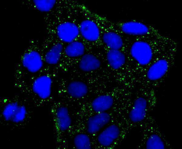 a04943 prkar2b primary antiboties icc testing 1