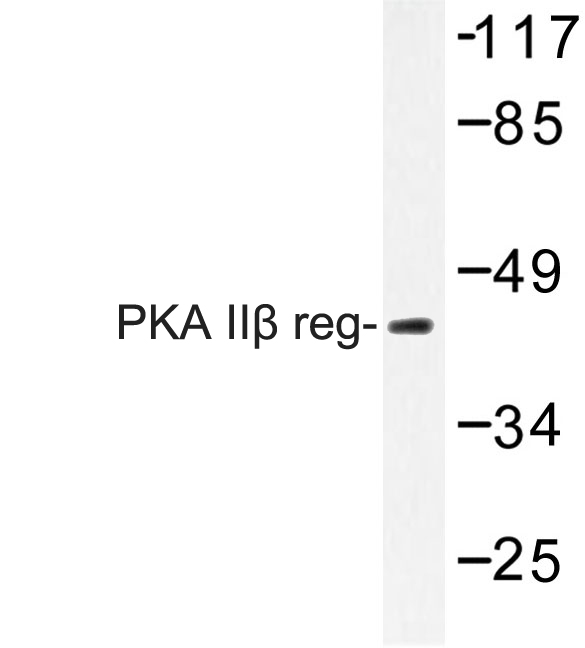 Western blot (WB) analysis of PKA IIβ reg (T109) polyclonal antibody at 1:500 dilution
Lane1:HEK293T whole cell lysate
Lane2:Raw264