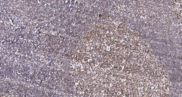 a04944 1 setmar primary antibodies ihc testing 1