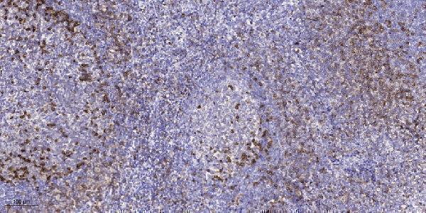 a04947 lrba primary antibodies ihc testing 1