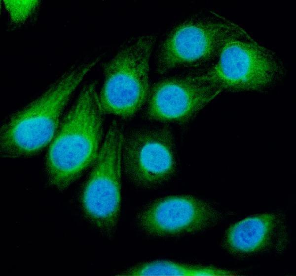 IF analysis of NLGN1 using anti-NLGN1 antibody (A04948-1)