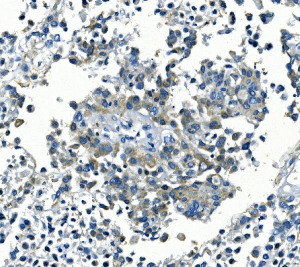 IHC analysis of Kir6