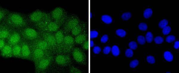 a04951 atf7 primary antiboties icc testing 1