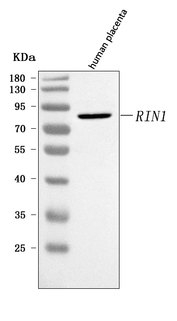  Western blot analysis of RIN1 using anti-RIN1 antibody (A04953-1)