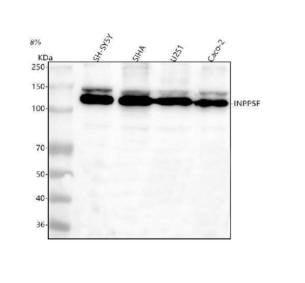 Western blot analysis of INPP5F using anti-INPP5F antibody (A04954-1)