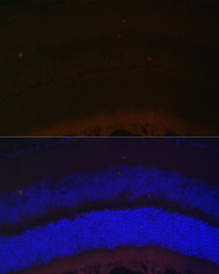 a04955 rdh5 primary antiboties if testing 2