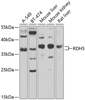 a04955 rdh5 primary antiboties wb testing 1