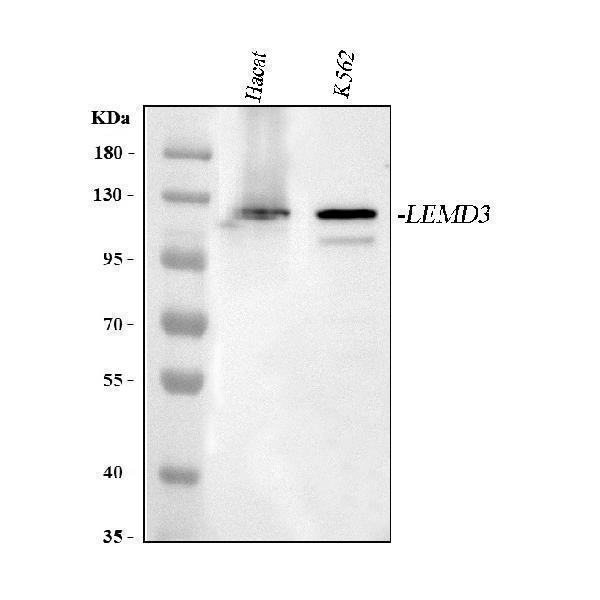  Western blot analysis of MAN1/LEMD3 using anti-MAN1/LEMD3 antibody (A04957-1)