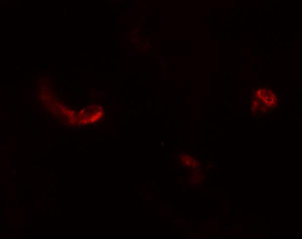 Immunofluorescence of LEMD3 in human colon tissue with LEMD3 antibody at 5 μg/mL