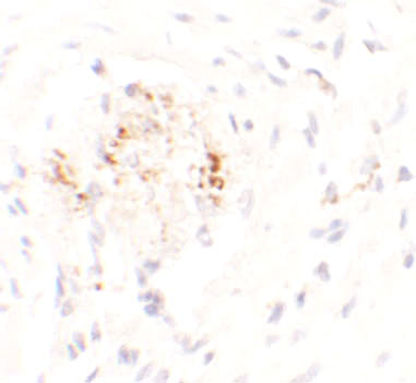 Immunohistochemistry of LEMD3 in human colon tissue with LEMD3 antibody at 2