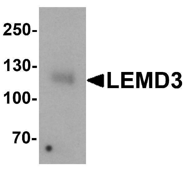Western blot analysis of LEMD3 in human colon tissue lysate with LEMD3 antibody at 1 μg/mL