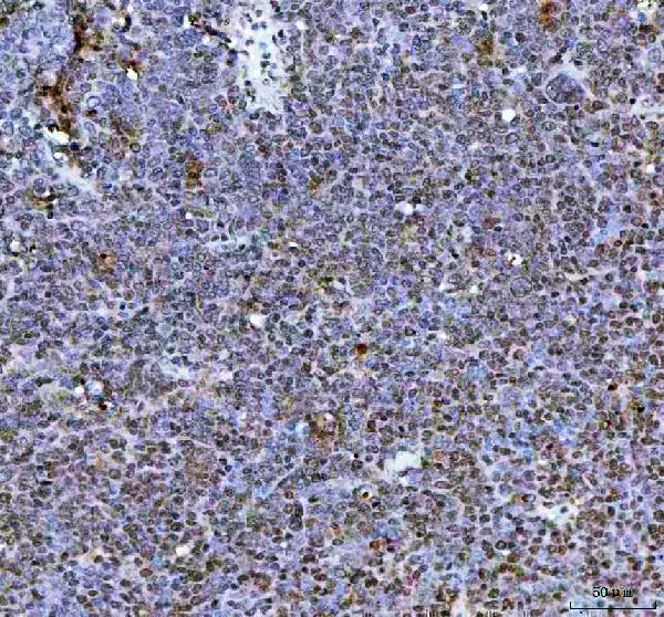  IHC analysis of NR1D2 using anti-NR1D2 antibody (A04958-2)