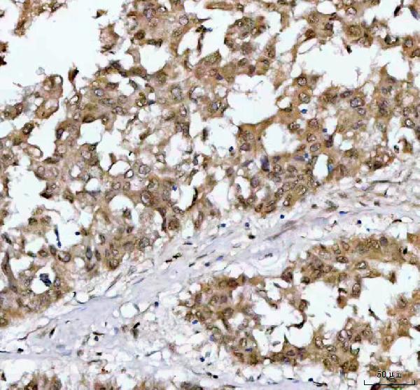  IHC analysis of NR1D2 using anti-NR1D2 antibody (A04958-2)