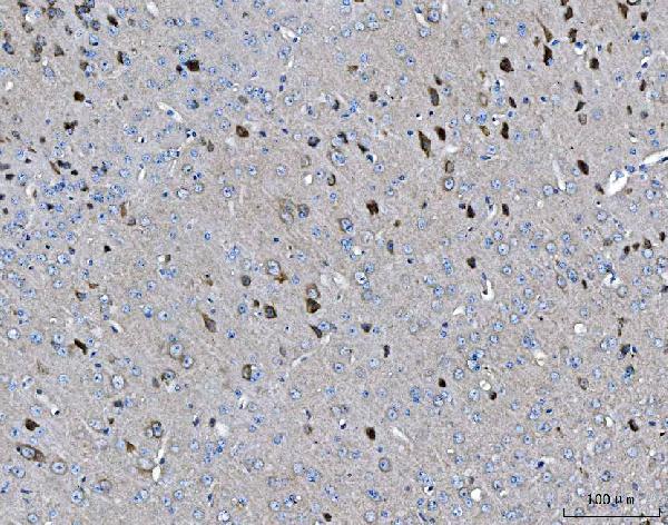 a04959 arfgap1 primary antibodies ihc testing 2