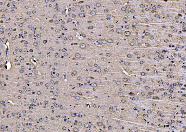 a04959 arfgap1 primary antibodies ihc testing 3