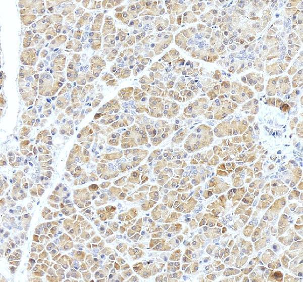 a04959 arfgap1 primary antibodies ihc testing 4