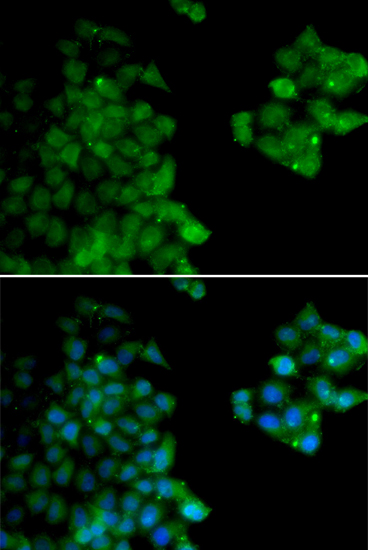 Immunofluorescence analysis of HeLa cells using PSMB10 antibody 
