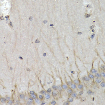 Immunohistochemistry of paraffin-embedded rat brain using PSMB10 antibody  at dilution of 1:200 