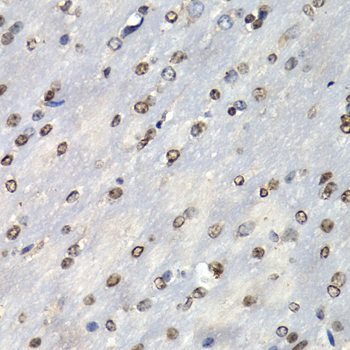 a04960 psmb10 primary antiboties ihc testing 3