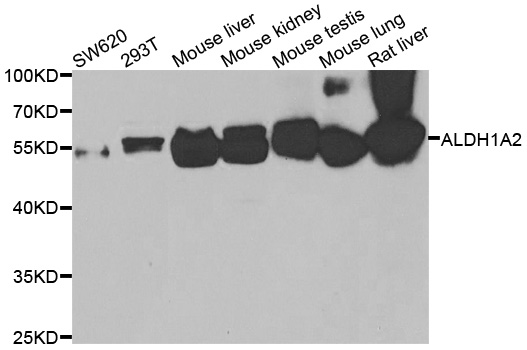 Western blot analysis of extracts of various cell lines, using ALDH1A2 antibody