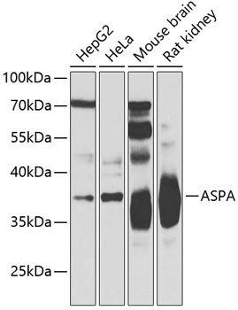a04962 aspa primary antiboties wb testing 1