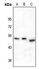 Western blot analysis of EP2 expression in A549 (A), HEK293T (B), mouse lung (C) whole cell lysates