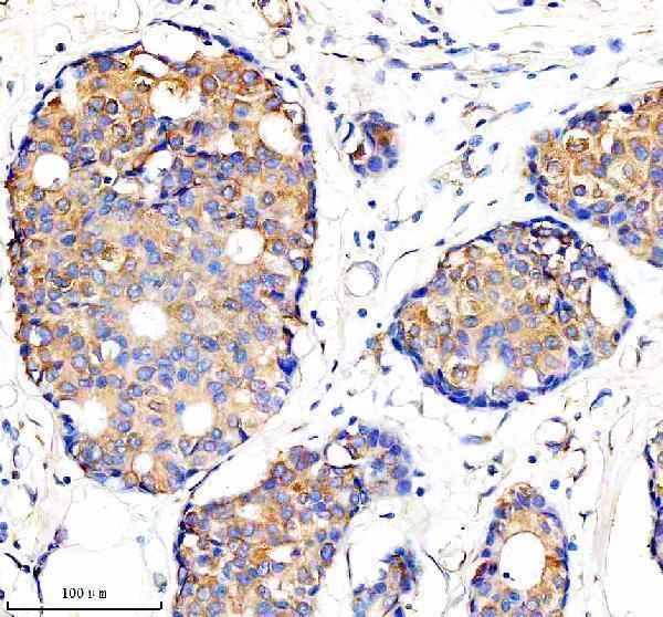  IHC analysis of IFITM2 using anti-IFITM2 antibody (A04964-2)