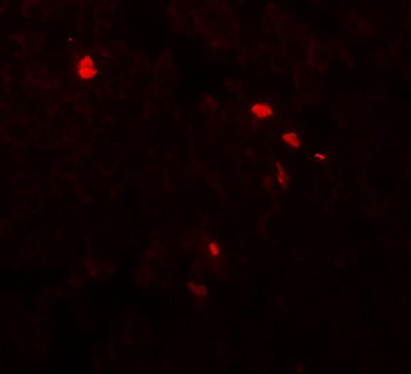 a04966 1 tmem107 primary antibodies if testing 3