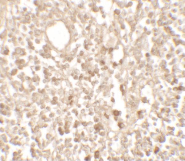 a04966 1 tmem107 primary antibodies ihc testing 2