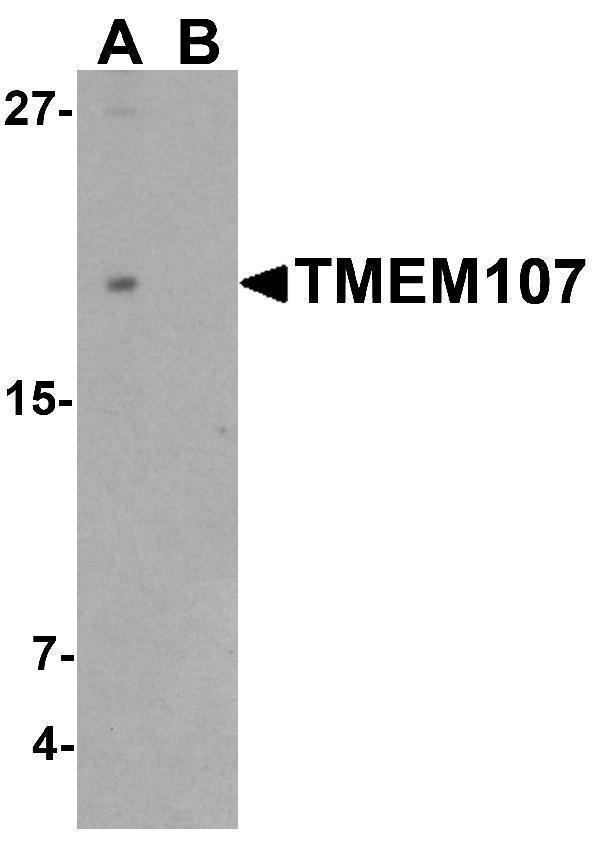 a04966 1 tmem107 primary antibodies wb testing 1
