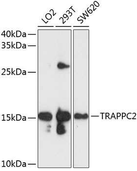 a04968 trappc2 primary antiboties wb testing 1